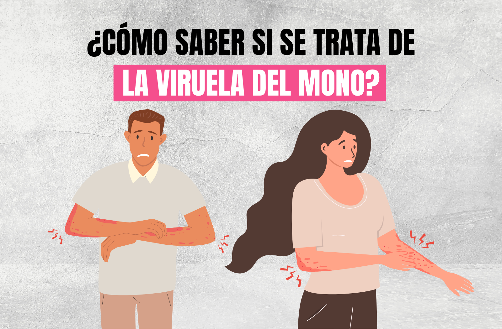 ¿Cómo saber si se trata de la viruela del mono?